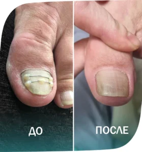 пример - 1