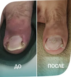 пример - 4