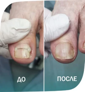 пример - 6