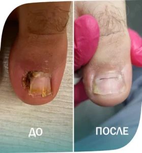 пример - 4