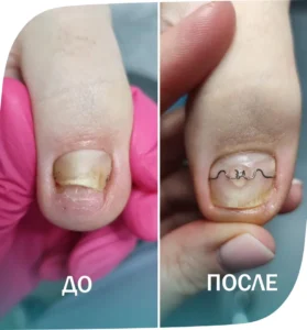 пример - 5