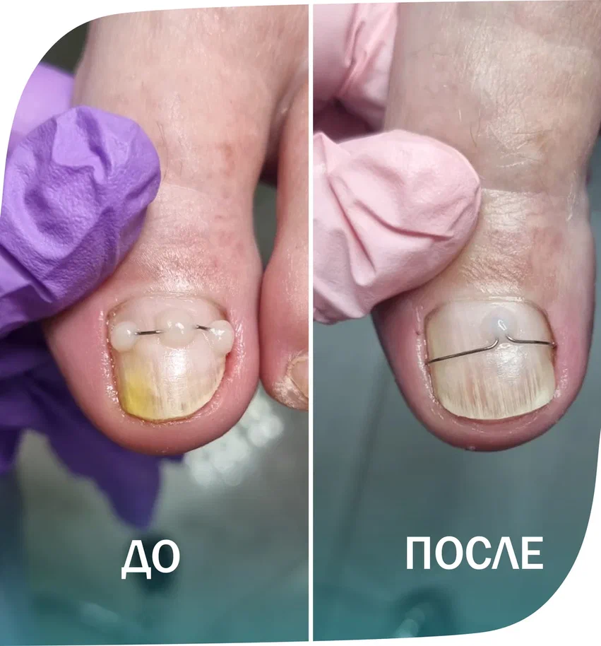 скоба