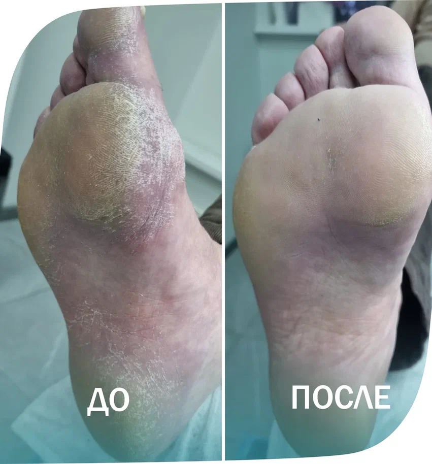 обработка