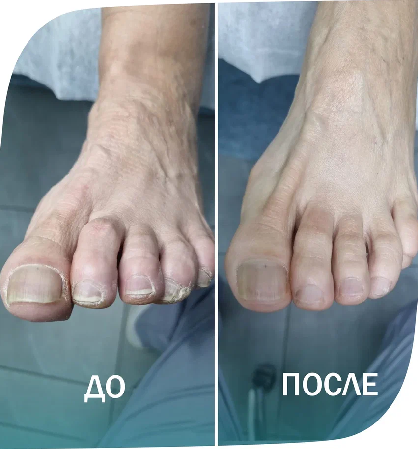 нога