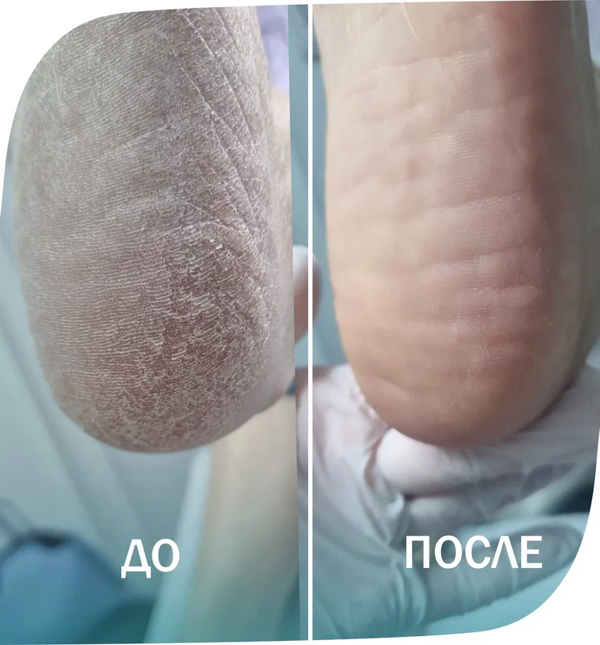 подология
