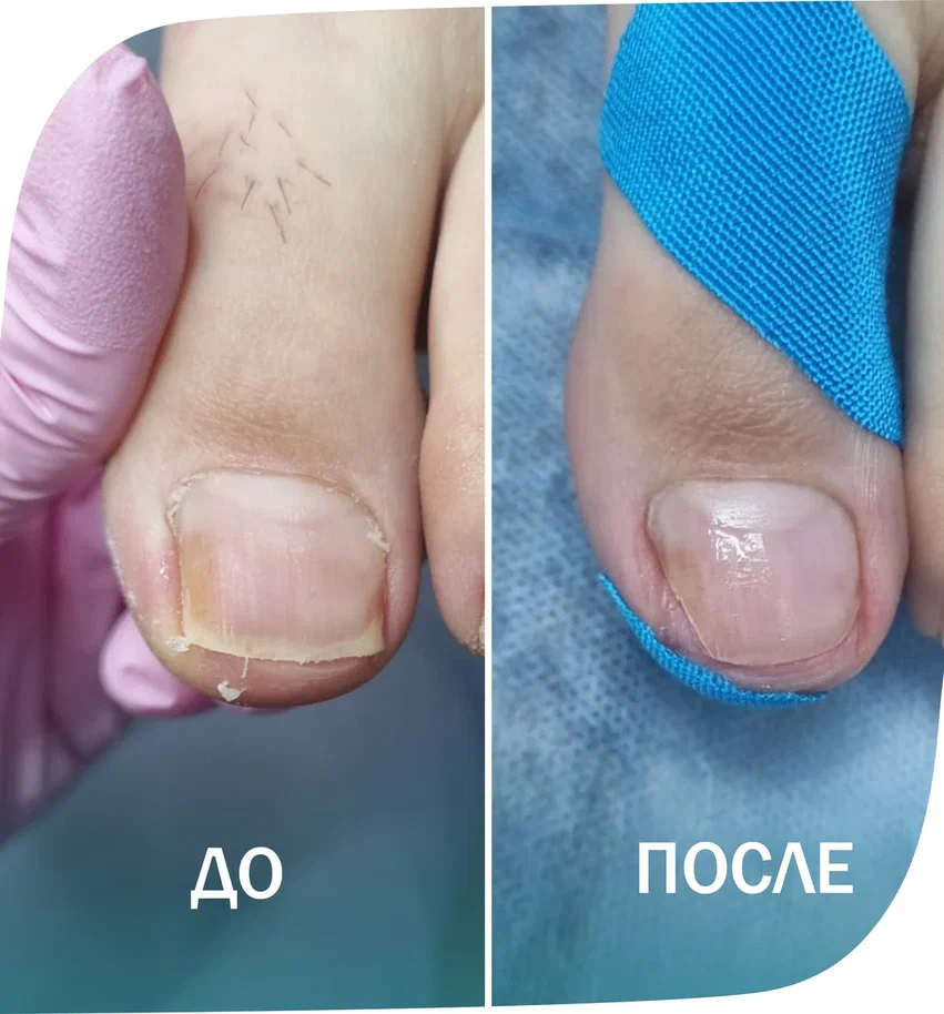 тейпы