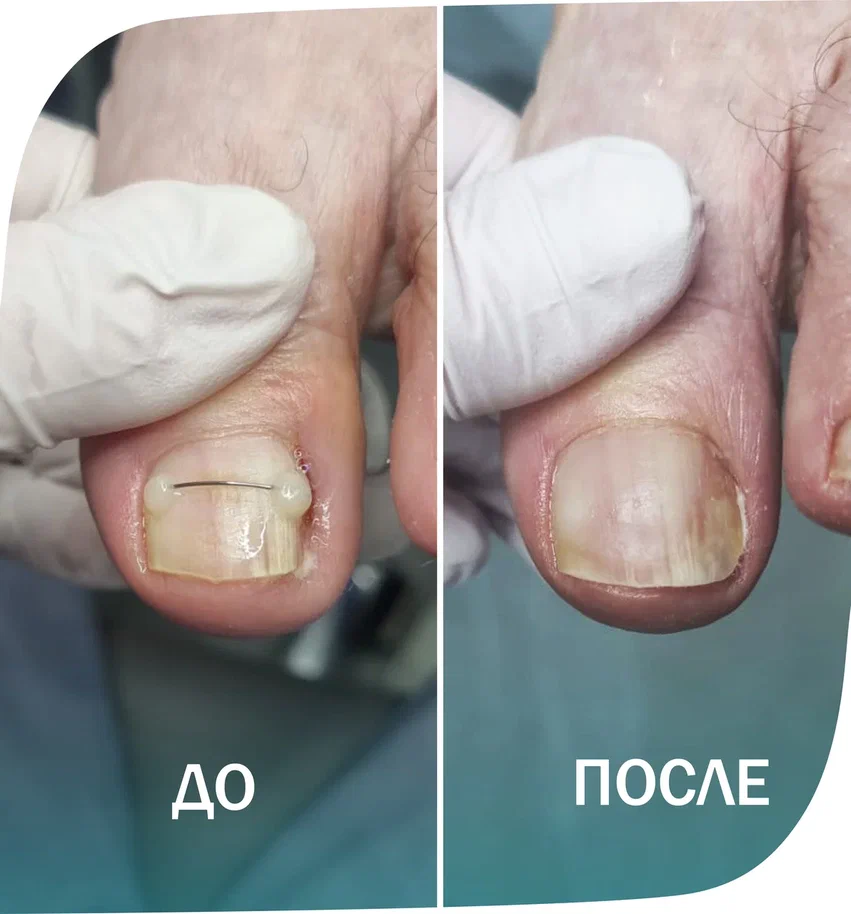 коррекция