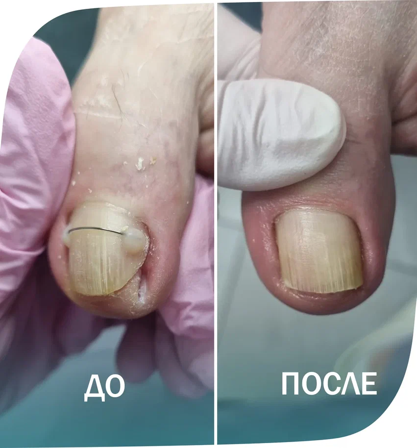 коррекционная система