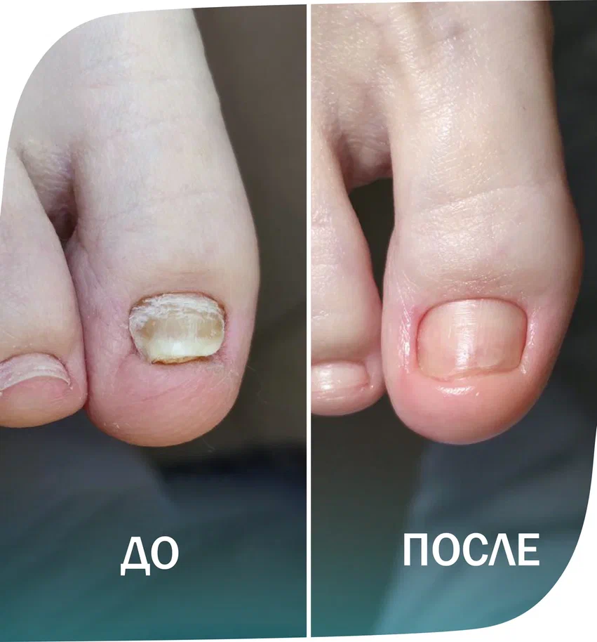 ногтевая пластина
