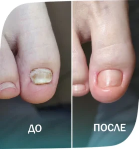 пример 1