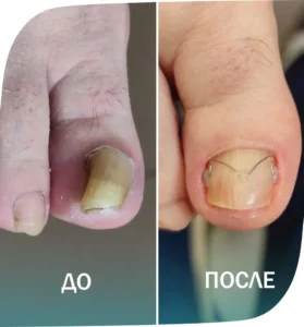 пример 5